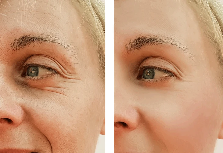 Skin care effect Skin care effect